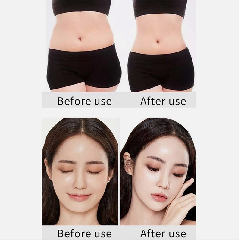 Bio Healing 6-in-1 Ultrasonic Cavitation + RF Machine