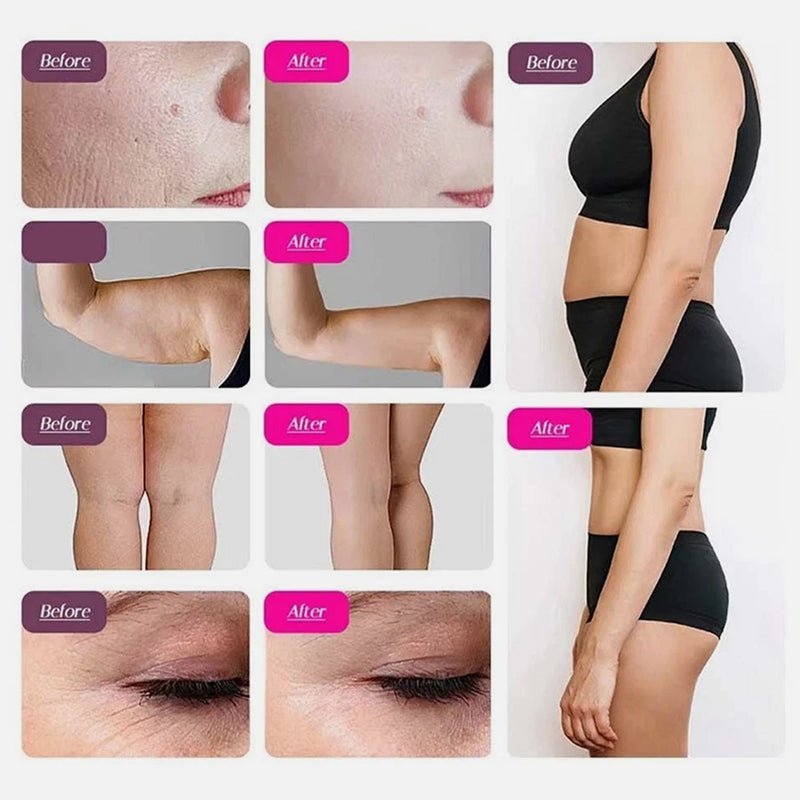 9 - in - 1 Ultrasonic Cavitation & RF Body Contouring Beauty Machine (80K Technology)